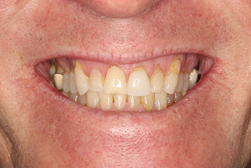 before photo of patient